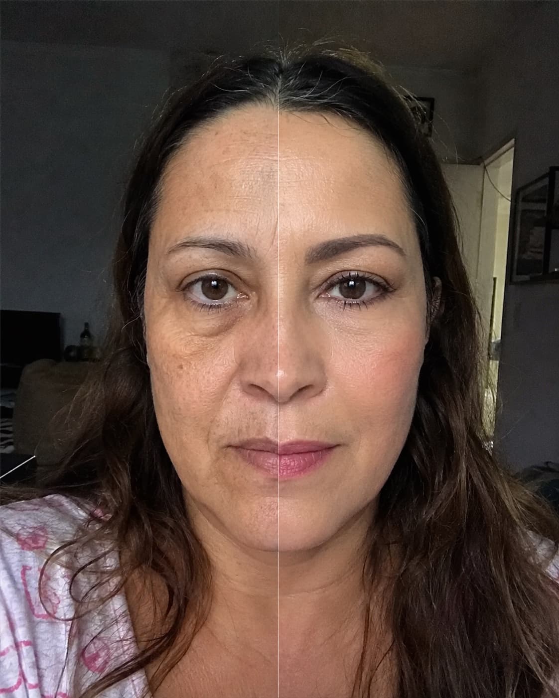 Antes e depois — resultado real com o Protocolo Lumina